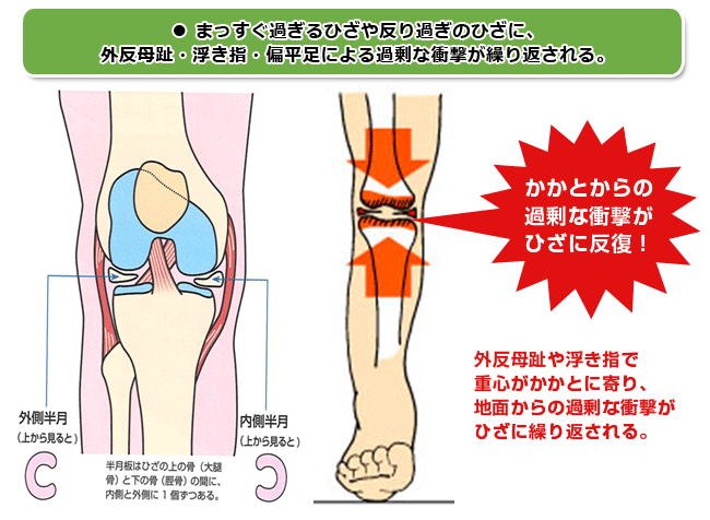 ８方向の診断から 自分のひざの痛みを知る ひざの痛みサイト